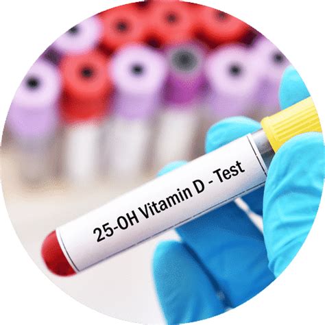 food intolerance test philippines|MetaMetrics Laboratory Philippines .